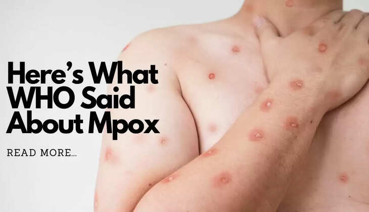 mpox